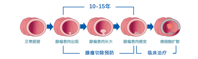 2021大鵬新區(qū)開(kāi)展45-74歲居民結(jié)直腸癌篩查項(xiàng)目的社康中心